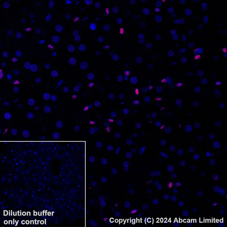 Immunohistochemistry (Formalin/PFA-fixed paraffin-embedded sections) - Alexa Fluor® 647 Anti-NR2F2 antibody [EPR18443] (AB270116)