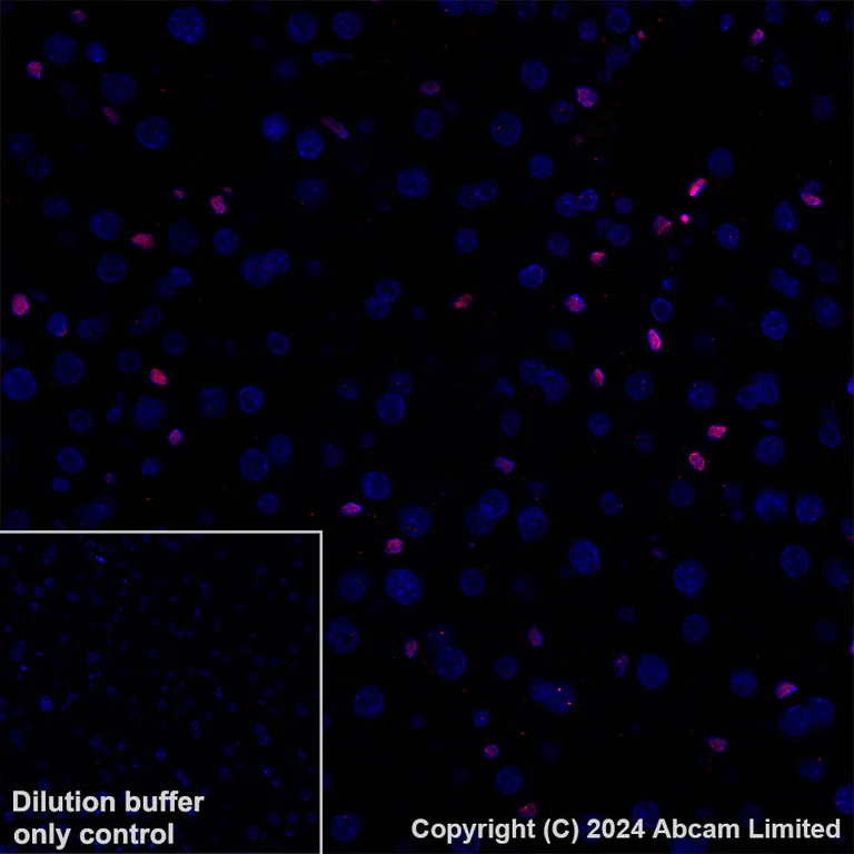 Immunohistochemistry (Formalin/PFA-fixed paraffin-embedded sections) - Alexa Fluor® 647 Anti-NR2F2 antibody [EPR18443] (AB270116)
