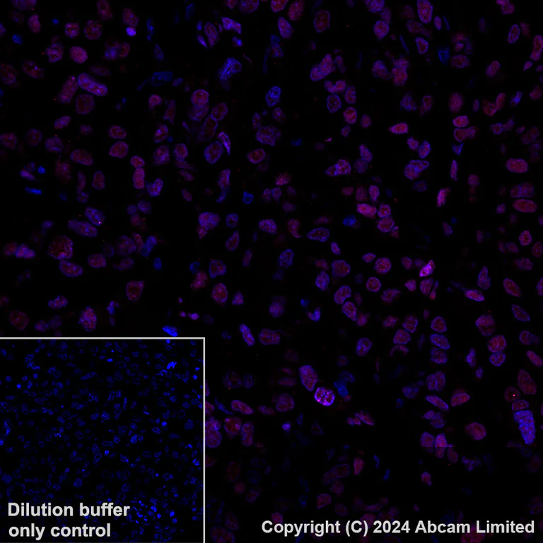 Immunohistochemistry (Formalin/PFA-fixed paraffin-embedded sections) - Alexa Fluor® 647 Anti-NR2F2 antibody [EPR18443] (AB270116)
