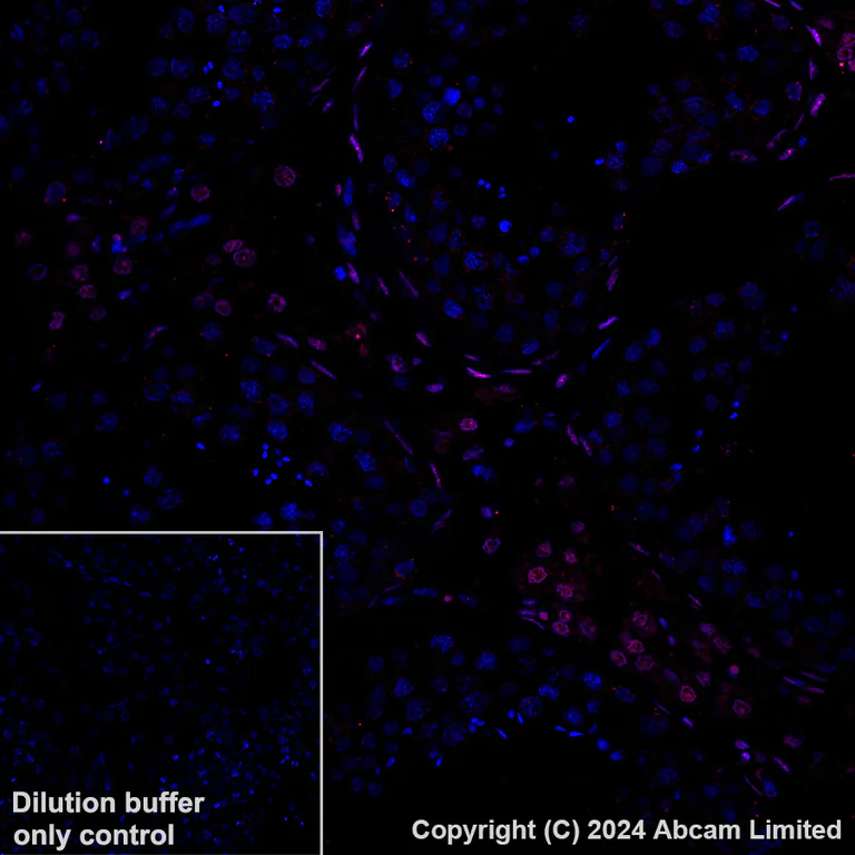 Immunohistochemistry (Formalin/PFA-fixed paraffin-embedded sections) - Alexa Fluor® 647 Anti-NR2F2 antibody [EPR18443] (AB270116)