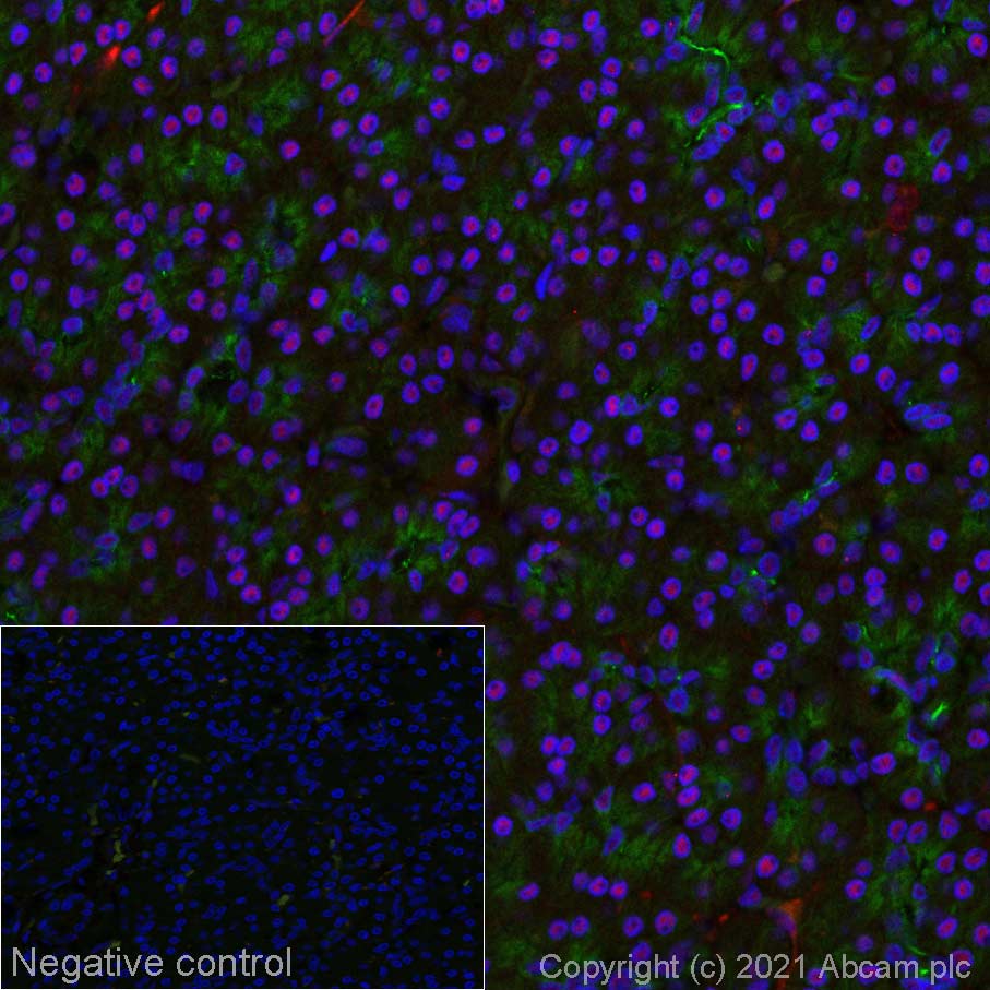 Immunohistochemistry (Formalin/PFA-fixed paraffin-embedded sections) - Alexa Fluor® 647 Anti-NSUN2/SAKI antibody [EPR24140-93] (AB281323)
