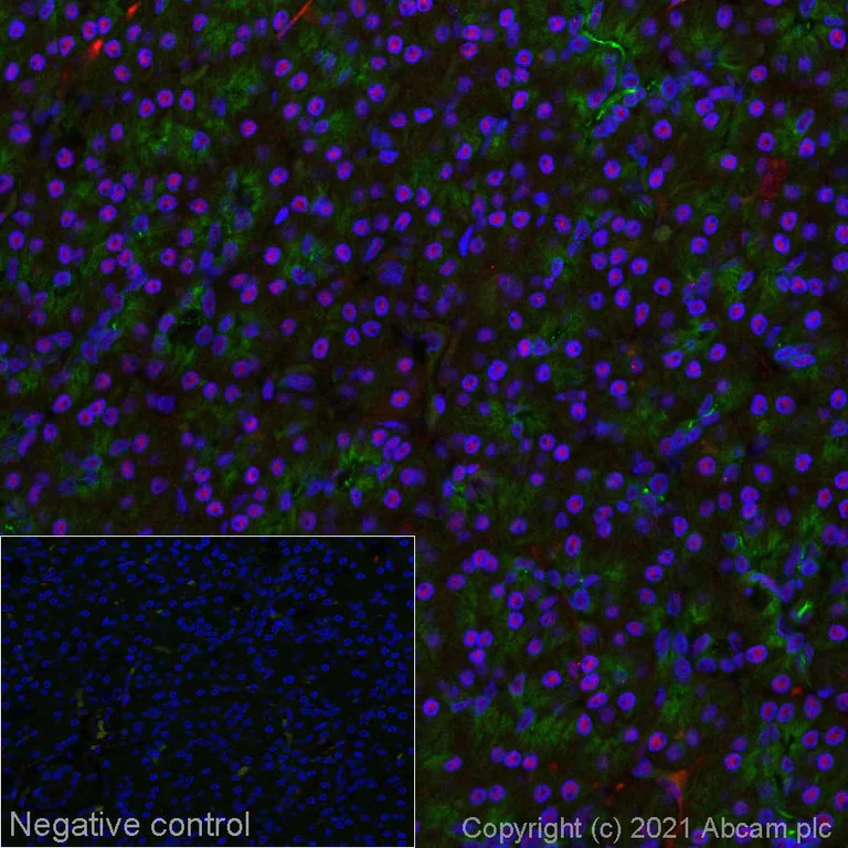 Immunohistochemistry (Formalin/PFA-fixed paraffin-embedded sections) - Alexa Fluor® 647 Anti-NSUN2/SAKI antibody [EPR24140-93] (AB281323)