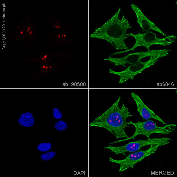 Immunocytochemistry/ Immunofluorescence - Alexa Fluor® 647 Anti-Nucleolin antibody [364-5] (AB198580)