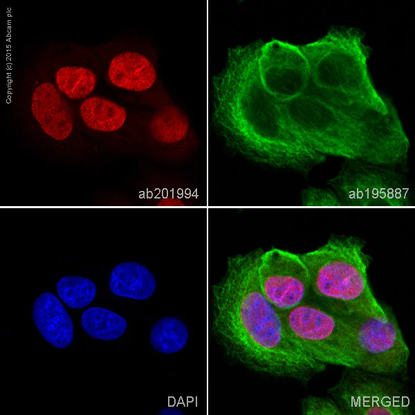 Immunocytochemistry/ Immunofluorescence - Alexa Fluor® 647 Anti-O-Linked N-Acetylglucosamine antibody [RL2] (AB201994)
