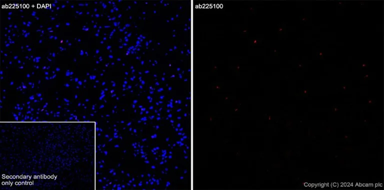 Immunohistochemistry (Frozen sections) - Alexa Fluor® 647 Anti-Olig2 antibody [EPR2673] - Oligodendrocyte Marker (AB225100)