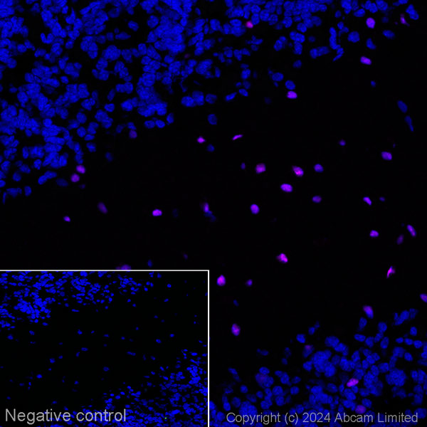 Immunohistochemistry (Frozen sections) - Alexa Fluor® 647 Anti-Olig2 antibody [EPR2673] - Oligodendrocyte Marker (AB225100)