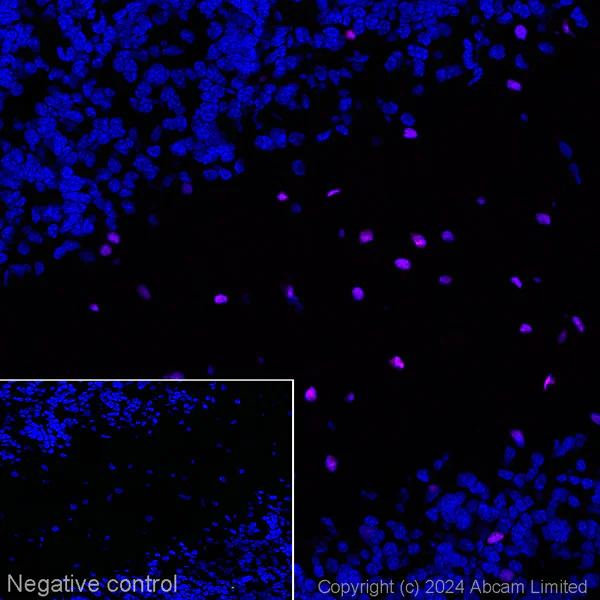 Immunohistochemistry (Frozen sections) - Alexa Fluor® 647 Anti-Olig2 antibody [EPR2673] - Oligodendrocyte Marker (AB225100)