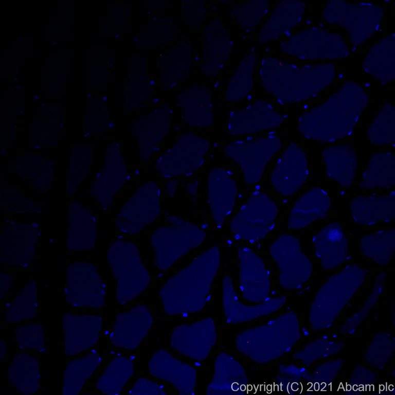 Immunohistochemistry (Formalin/PFA-fixed paraffin-embedded sections) - Alexa Fluor® 647 Anti-Osteopontin antibody [EPR21139-316] (AB283696)