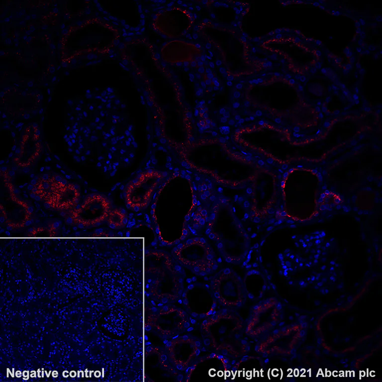Immunohistochemistry (Formalin/PFA-fixed paraffin-embedded sections) - Alexa Fluor® 647 Anti-Osteopontin antibody [EPR21139-316] (AB283696)