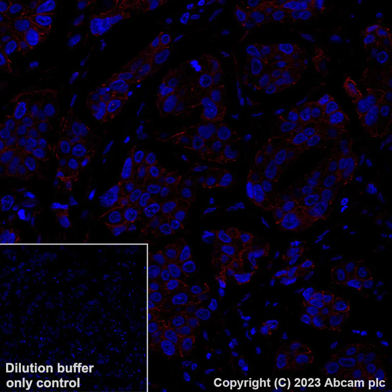 Immunohistochemistry (Formalin/PFA-fixed paraffin-embedded sections) - Alexa Fluor® 647 Anti-P cadherin antibody [EPR22426] (AB314928)