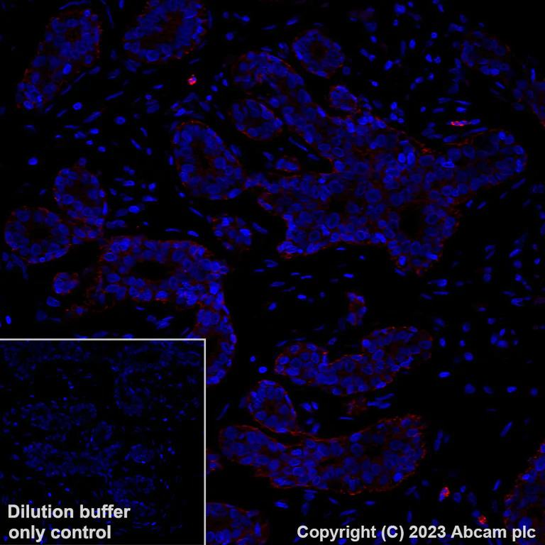Immunohistochemistry (Formalin/PFA-fixed paraffin-embedded sections) - Alexa Fluor® 647 Anti-P cadherin antibody [EPR22426] (AB314928)