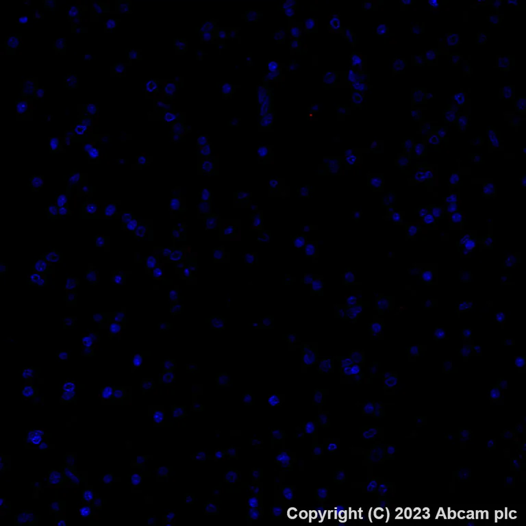 Immunohistochemistry (Formalin/PFA-fixed paraffin-embedded sections) - Alexa Fluor® 647 Anti-P cadherin antibody [EPR22426] (AB314928)