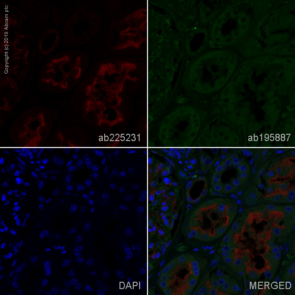 Immunohistochemistry (Formalin/PFA-fixed paraffin-embedded sections) - Alexa Fluor® 647 Anti-P Glycoprotein antibody [EPR10364-57] (AB225231), expandable thumbnail