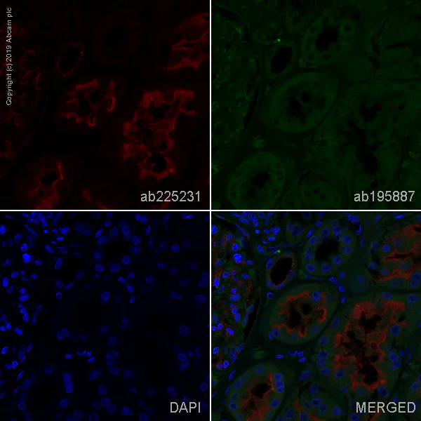 Immunohistochemistry (Formalin/PFA-fixed paraffin-embedded sections) - Alexa Fluor® 647 Anti-P Glycoprotein antibody [EPR10364-57] (AB225231)