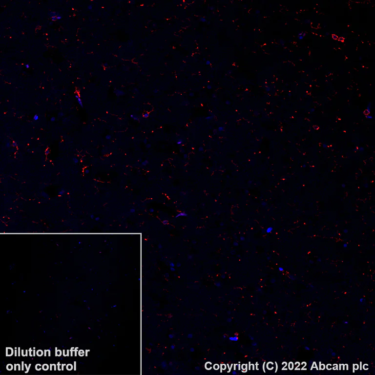 Immunohistochemistry (Formalin/PFA-fixed paraffin-embedded sections) - Alexa Fluor® 647 Anti-P2Y12 antibody [EPR23511-72] (AB305211)