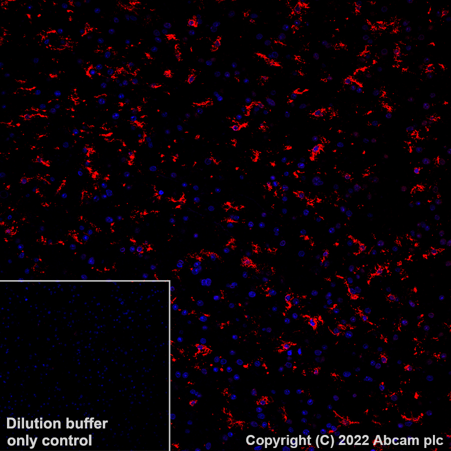 Immunohistochemistry (Formalin/PFA-fixed paraffin-embedded sections) - Alexa Fluor® 647 Anti-P2Y12 antibody [EPR23511-72] (AB305211)
