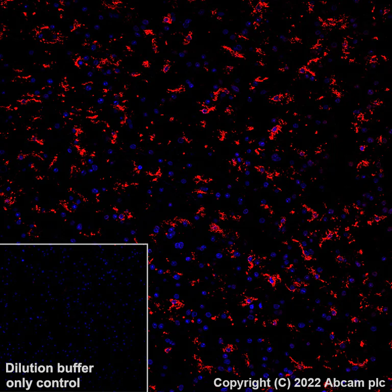 Immunohistochemistry (Formalin/PFA-fixed paraffin-embedded sections) - Alexa Fluor® 647 Anti-P2Y12 antibody [EPR23511-72] (AB305211)
