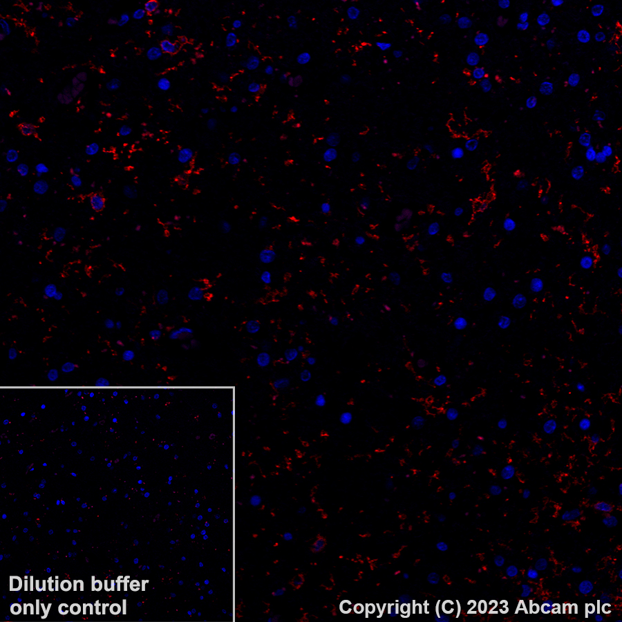 Immunohistochemistry (Formalin/PFA-fixed paraffin-embedded sections) - Alexa Fluor® 647 Anti-P2Y12 antibody [EPR26298-93] (AB308432)