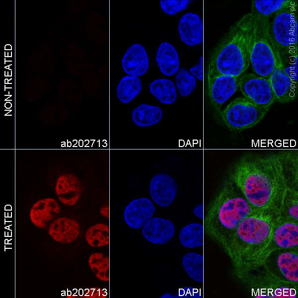 Immunocytochemistry/ Immunofluorescence - Alexa Fluor® 647 Anti-p53 (acetyl K370) antibody [EPR17496] (AB202713), expandable thumbnail