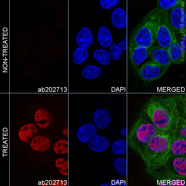 Immunocytochemistry/ Immunofluorescence - Alexa Fluor® 647 Anti-p53 (acetyl K370) antibody [EPR17496] (AB202713)