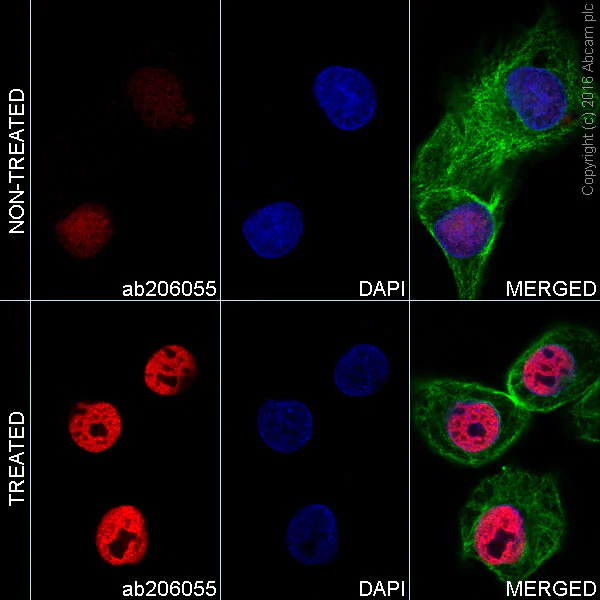 Immunocytochemistry/ Immunofluorescence - Alexa Fluor® 647 Anti-p53 (acetyl K373) antibody [EP356(2)AY] (AB206055)