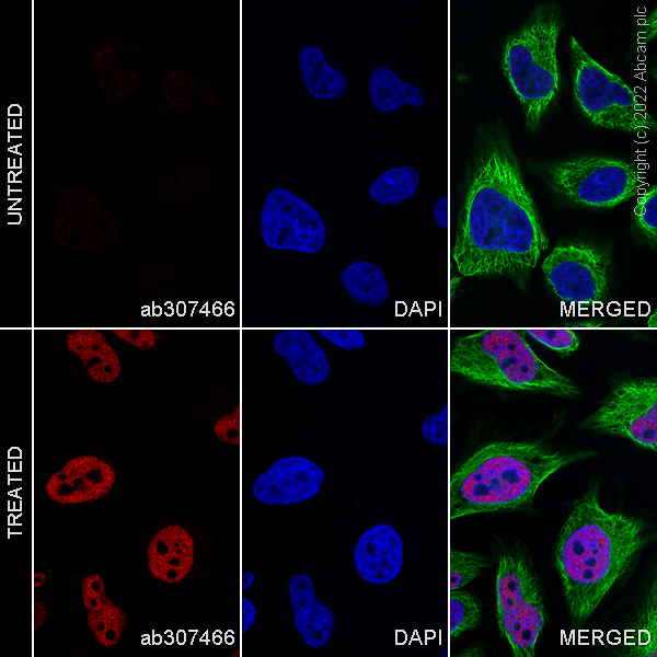 Immunocytochemistry/ Immunofluorescence - Alexa Fluor® 647 Anti-p53 (acetyl K382) antibody [EPR358(2)] (AB307466), expandable thumbnail