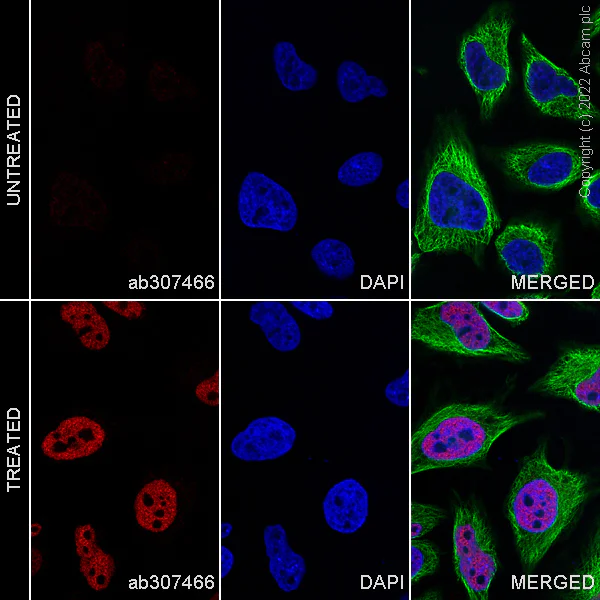 Immunocytochemistry/ Immunofluorescence - Alexa Fluor® 647 Anti-p53 (acetyl K382) antibody [EPR358(2)] (AB307466)