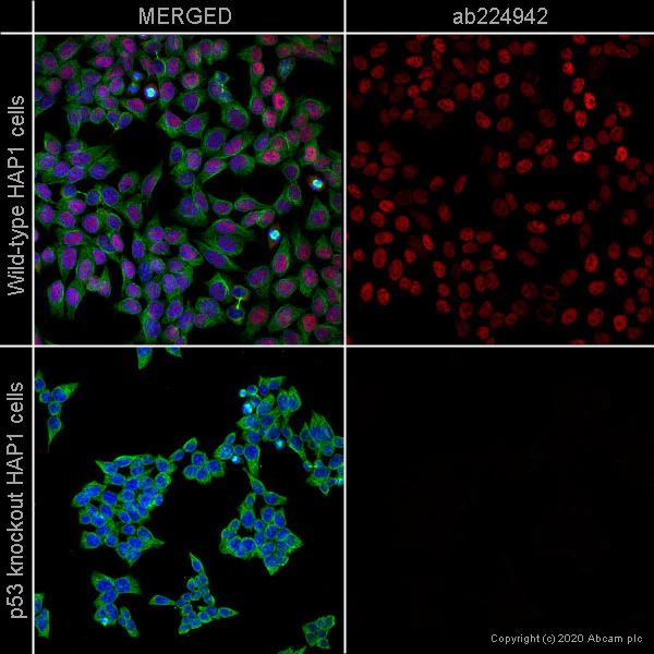 Immunocytochemistry/ Immunofluorescence - Alexa Fluor® 647 Anti-p53 antibody [E26] (AB224942)