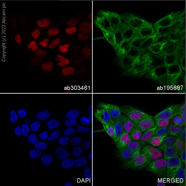Immunocytochemistry/ Immunofluorescence - Alexa Fluor® 647 Anti-p53 antibody [E47] (AB303461), expandable thumbnail