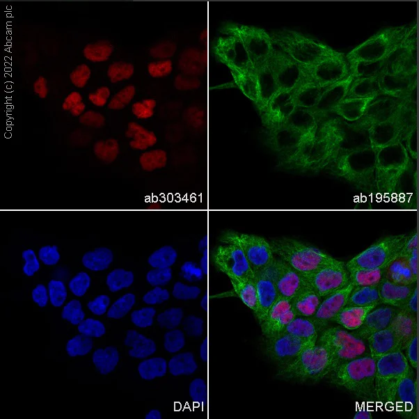 Immunocytochemistry/ Immunofluorescence - Alexa Fluor® 647 Anti-p53 antibody [E47] (AB303461)