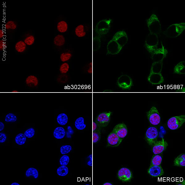 Immunocytochemistry - Alexa Fluor® 647 Anti-p53 antibody [EPR20416-120] (AB302696)