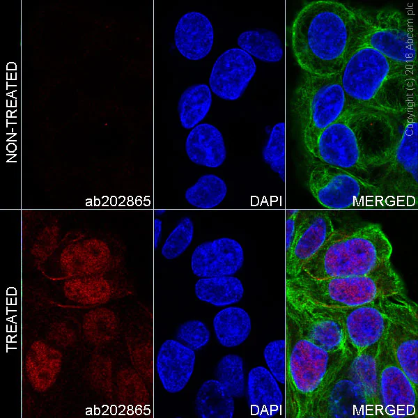 Immunocytochemistry/ Immunofluorescence - Alexa Fluor® 647 Anti-p53 (phospho S46) antibody [EP42Y] (AB202865)
