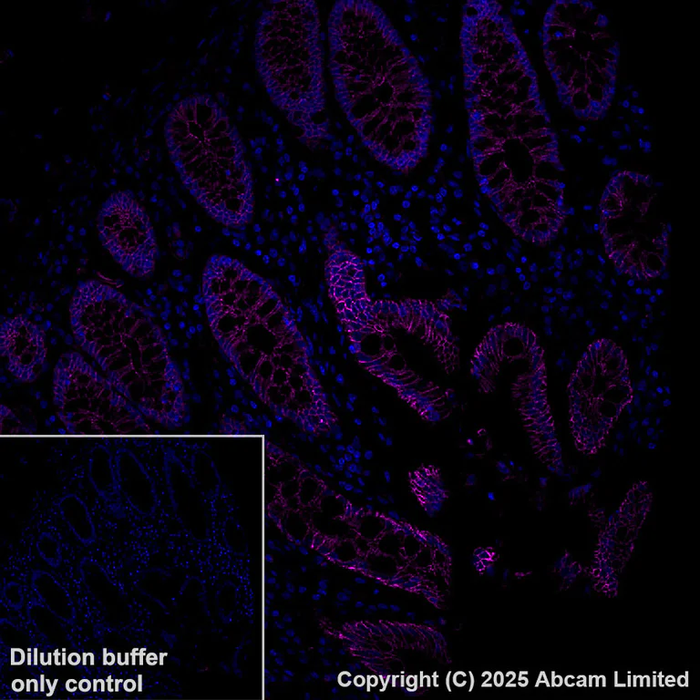 Immunohistochemistry (Formalin/PFA-fixed paraffin-embedded sections) - Alexa Fluor® 647 Anti-pan Cadherin antibody [EPR1792Y] - Intercellular Junction Marker (AB195203)