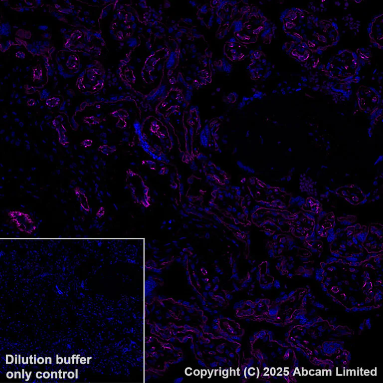 Immunohistochemistry (Formalin/PFA-fixed paraffin-embedded sections) - Alexa Fluor® 647 Anti-pan Cadherin antibody [EPR1792Y] - Intercellular Junction Marker (AB195203)