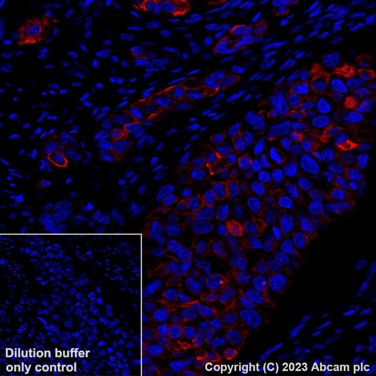 Alexa Fluor® 647 Anti-pan Cytokeratin antibody [C-11
