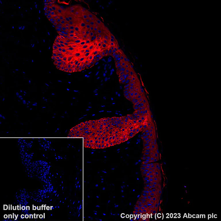 Immunohistochemistry (Formalin/PFA-fixed paraffin-embedded sections) - Alexa Fluor® 647 Anti-pan Cytokeratin antibody [C-11] (AB309978)