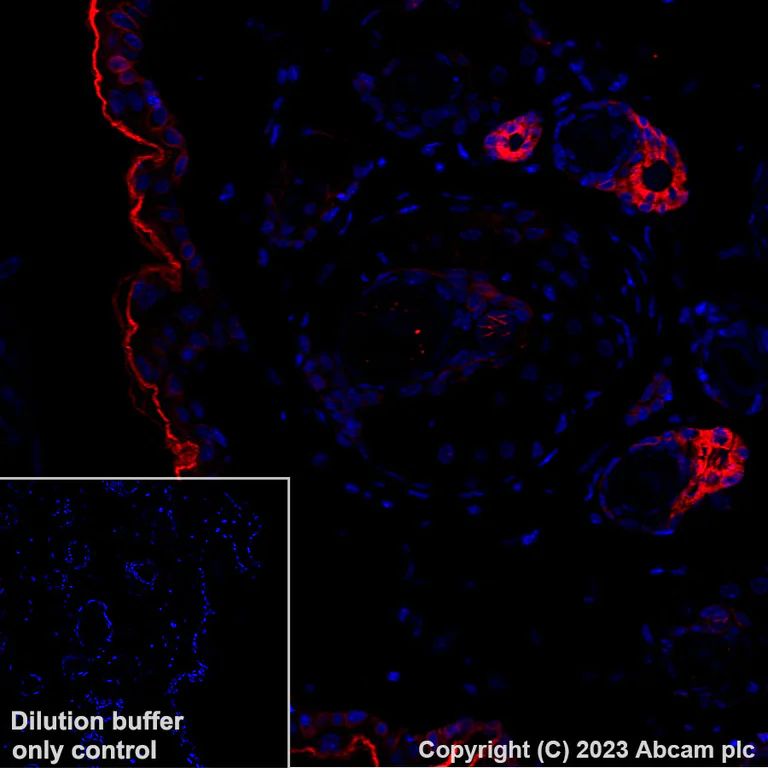 Immunohistochemistry (Formalin/PFA-fixed paraffin-embedded sections) - Alexa Fluor® 647 Anti-pan Cytokeratin antibody [C-11] (AB309978)