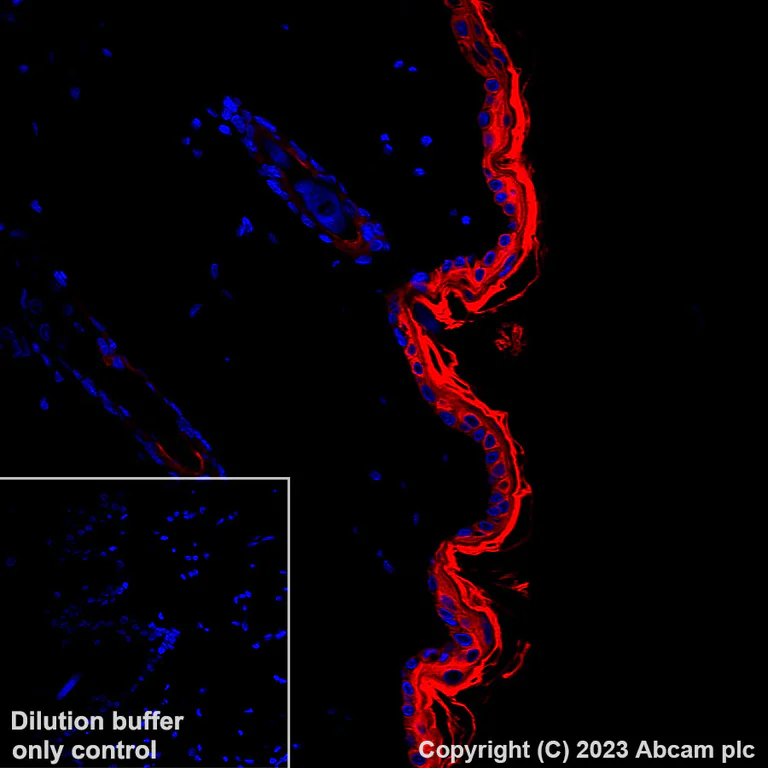 Immunohistochemistry (Formalin/PFA-fixed paraffin-embedded sections) - Alexa Fluor® 647 Anti-pan Cytokeratin antibody [C-11] (AB309978)