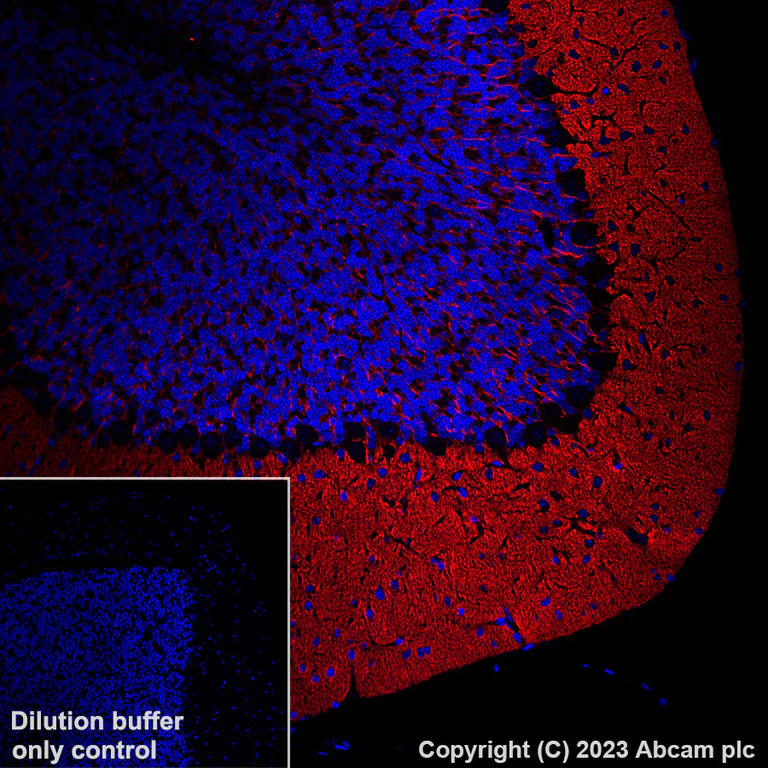 Immunohistochemistry (Formalin/PFA-fixed paraffin-embedded sections) - Alexa Fluor® 647 Anti-pan SCN antibody [EPR25134-4] (AB308534)