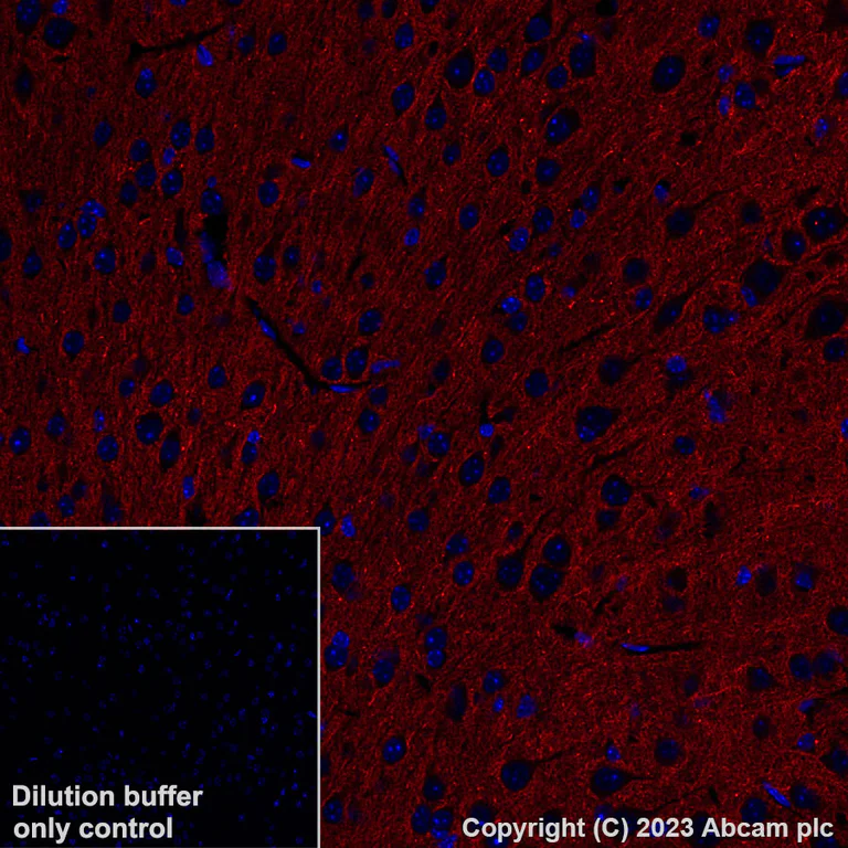 Immunohistochemistry (Formalin/PFA-fixed paraffin-embedded sections) - Alexa Fluor® 647 Anti-pan SCN antibody [EPR25134-4] (AB308534)