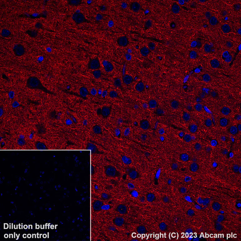 Immunohistochemistry (Formalin/PFA-fixed paraffin-embedded sections) - Alexa Fluor® 647 Anti-pan SCN antibody [EPR25134-4] (AB308534)