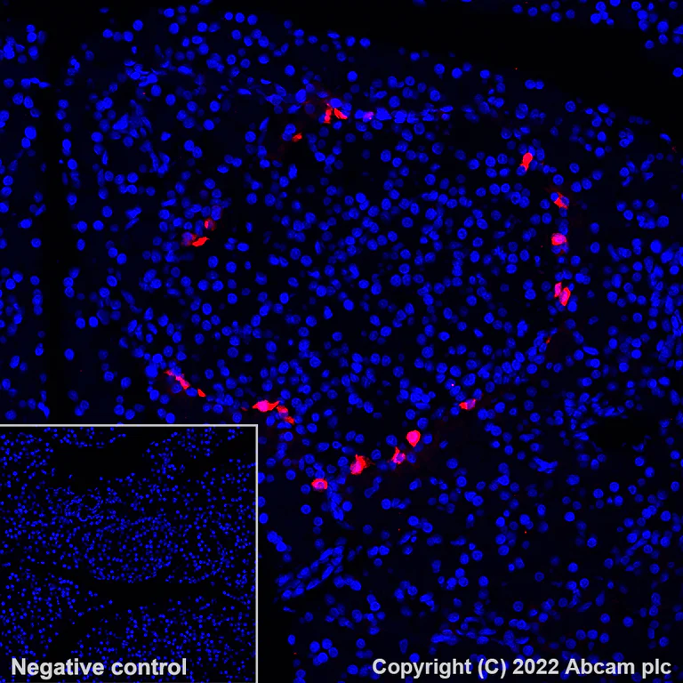 Immunohistochemistry (Formalin/PFA-fixed paraffin-embedded sections) - Alexa Fluor® 647 Anti-Pancreatic Polypeptide antibody [EPR23320-10] (AB300746)