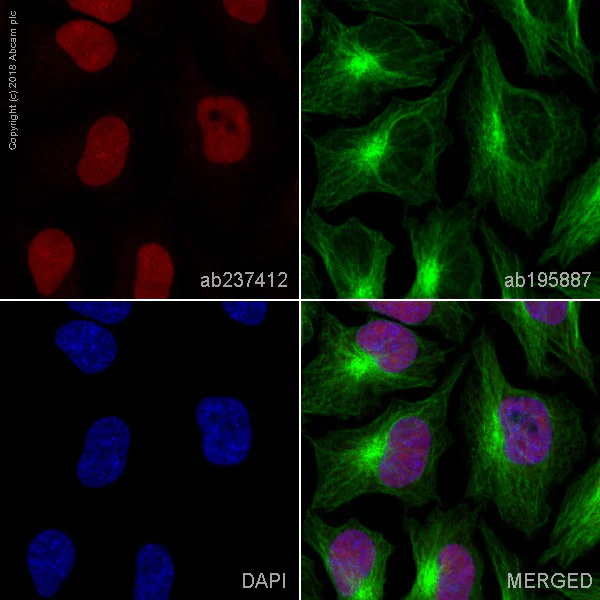 Immunocytochemistry/ Immunofluorescence - Alexa Fluor® 647 Anti-PARP1 antibody [E102] (AB237412)