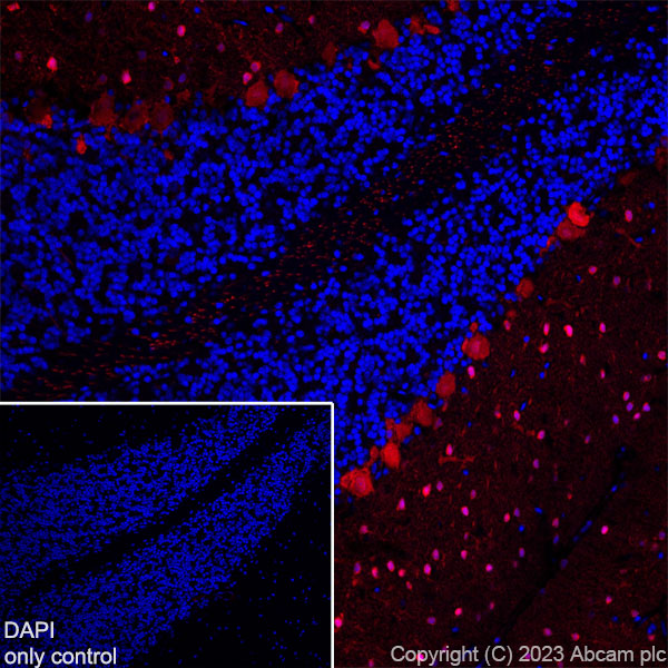 Immunohistochemistry (Frozen sections) - Alexa Fluor® 647 Anti-Parvalbumin antibody [EPR13091] (AB313816), expandable thumbnail