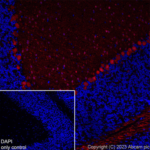 Immunohistochemistry (Frozen sections) - Alexa Fluor® 647 Anti-Parvalbumin antibody [EPR13091] (AB313816), expandable thumbnail
