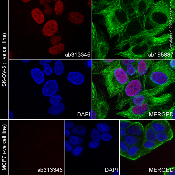 Immunocytochemistry/ Immunofluorescence - Alexa Fluor® 647 Anti-PAX8 - N-terminal antibody [SP348] (AB313345), expandable thumbnail