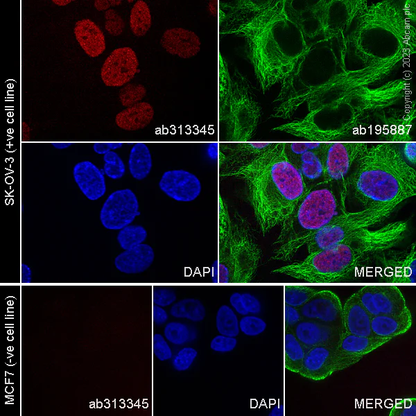 Immunocytochemistry/ Immunofluorescence - Alexa Fluor® 647 Anti-PAX8 - N-terminal antibody [SP348] (AB313345)