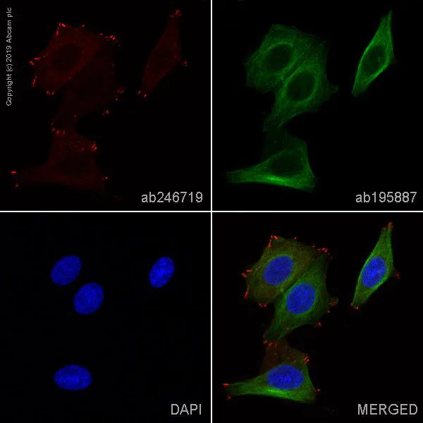Immunocytochemistry/ Immunofluorescence - Alexa Fluor® 647 Anti-Paxillin antibody [Y113] (AB246719)