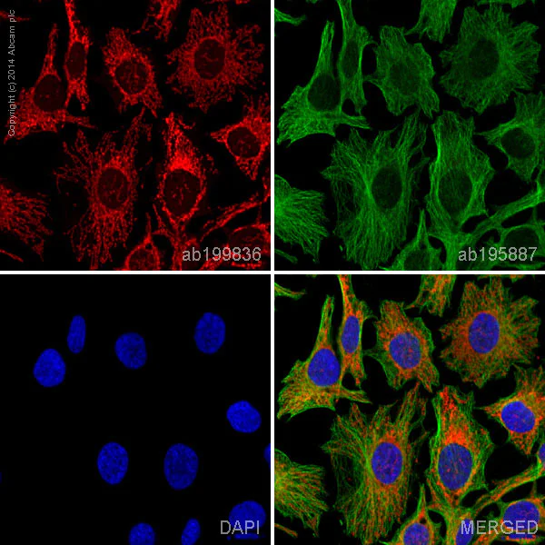 Immunocytochemistry - Alexa Fluor® 647 Anti-PBR antibody [EPR5384] (AB199836)