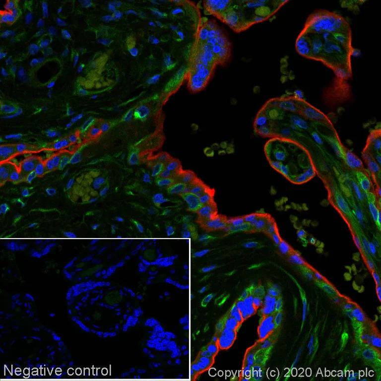 Immunohistochemistry (Formalin/PFA-fixed paraffin-embedded sections) - Alexa Fluor® 647 Anti-PD-L1 antibody [CAL10] (AB267565)